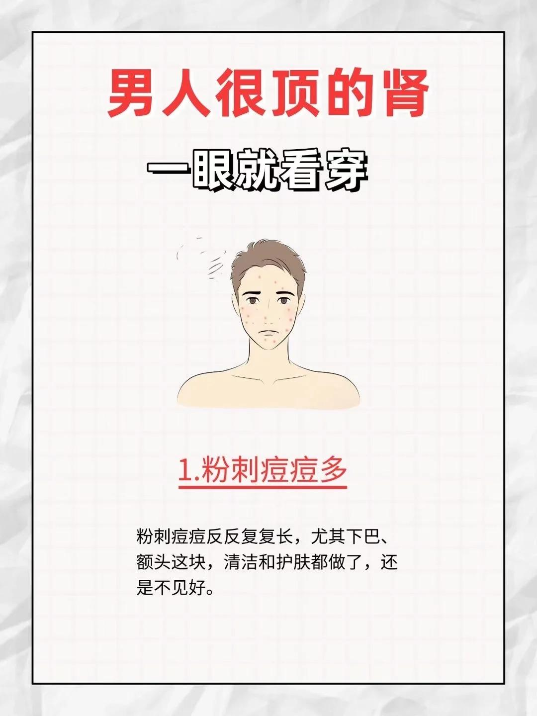 很顶的肾，一眼就能看穿