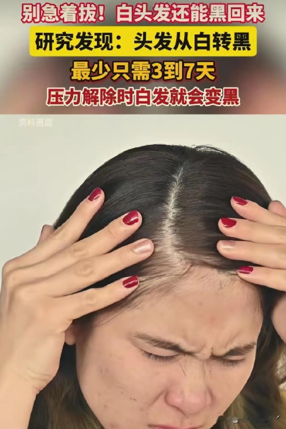 谁没对着镜子揪过白头发呢？越拔心里越慌，总怕白头发越拔越多。但是，哥伦比亚大