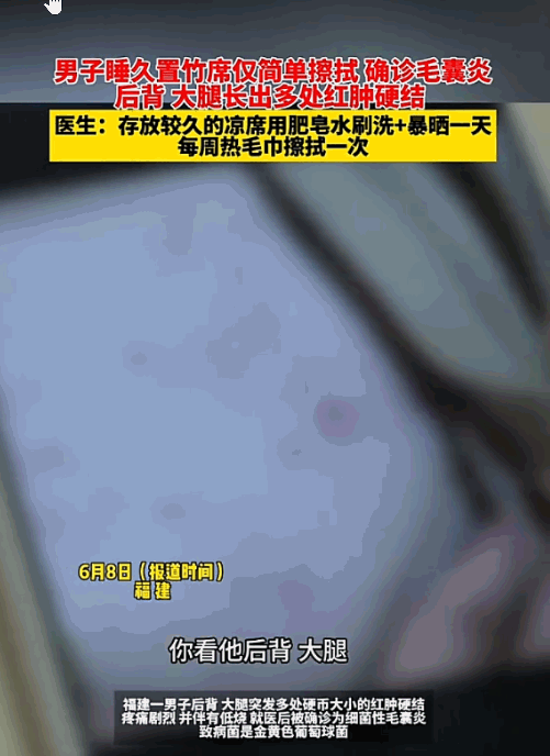 太吓人了！6月8日报道，福州有个老兄热得受不了，翻出了在柜子顶躺了一整年的陈年竹