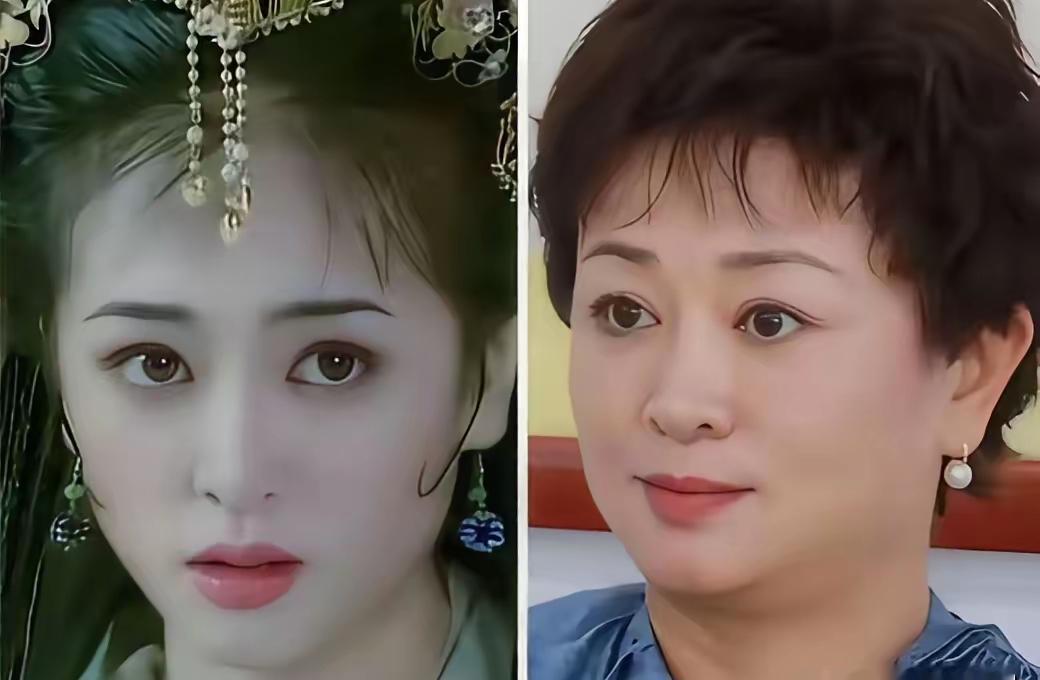 现在最危险的“传染病”，不在医院，在整容科。十年前选美，考官拿尺子量“三庭五眼