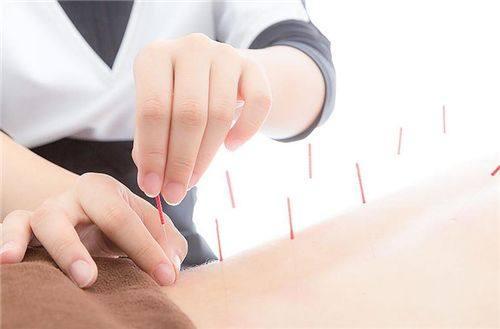 针灸为什么能立竿见影, 手到病除?