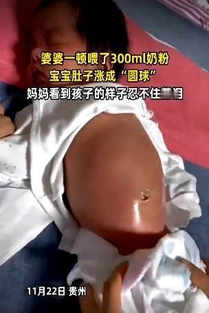 贵州，一宝妈去买菜，把孩子交给奶奶带。宝妈回来就看见孩子肚子鼓得跟个球一样，她