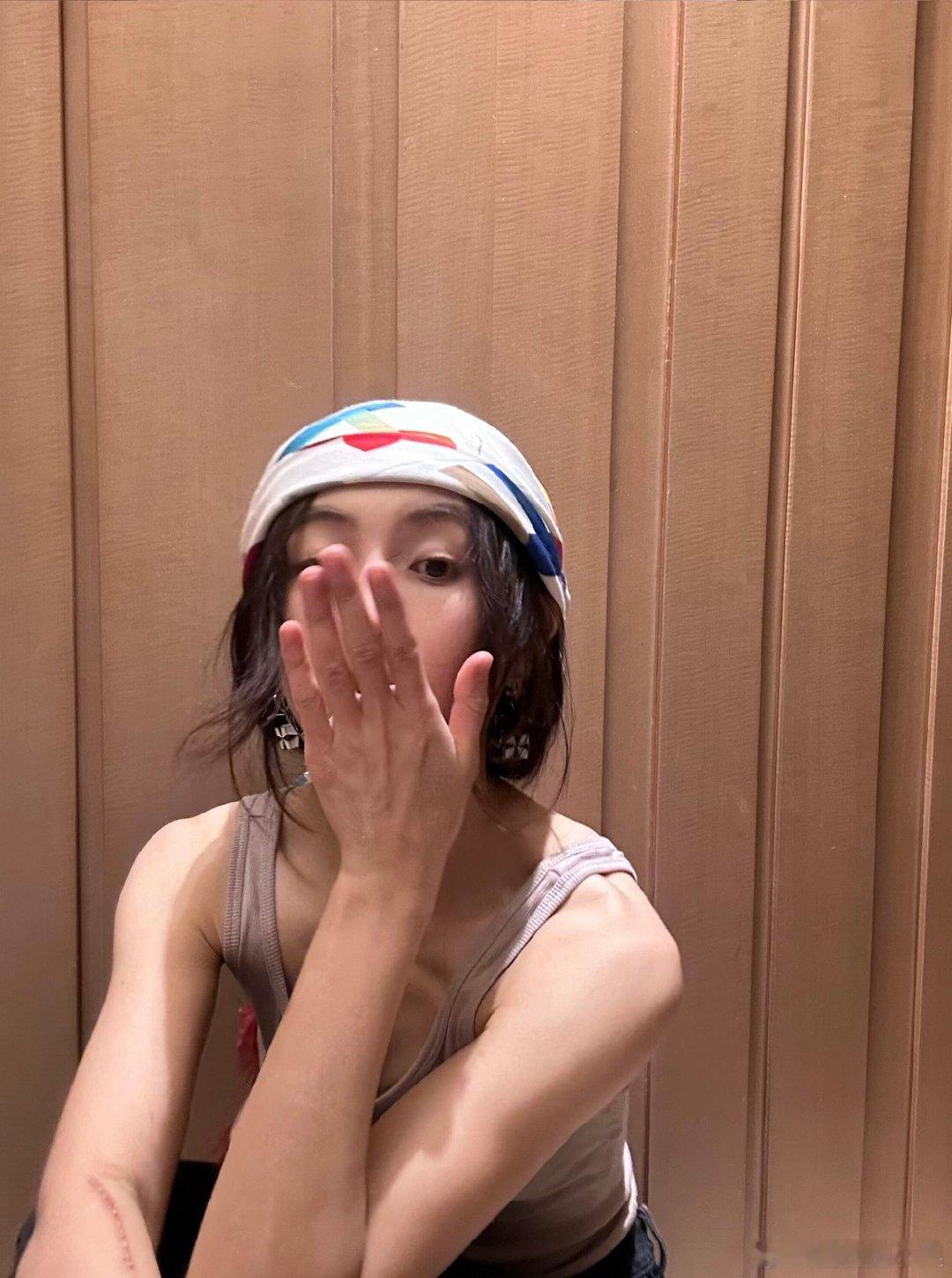 张子枫手臂伤疤张子枫晒出的照片可以看到手臂上的伤疤，真的要懂得保护好自己。张子枫