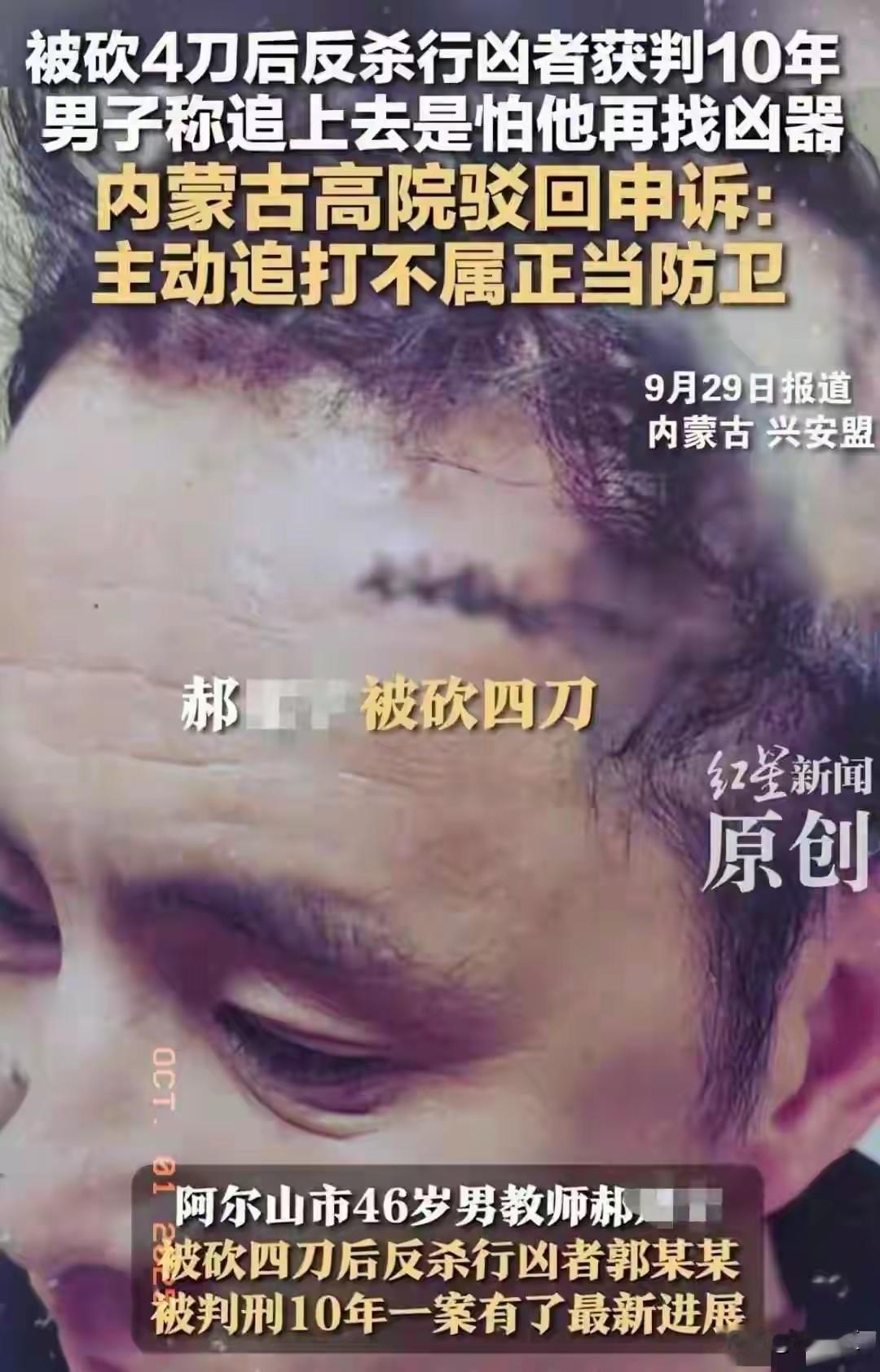 被砍四刀，反击后被判刑赔款！近日，内蒙高院一个判决引起社会争议。事情是:一位