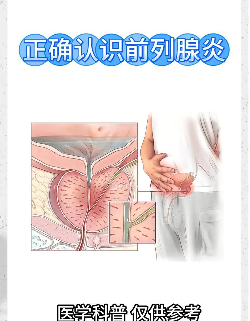 对于前列腺炎的一些认知错误最近很多年轻的患有前列腺炎的小伙子问我
