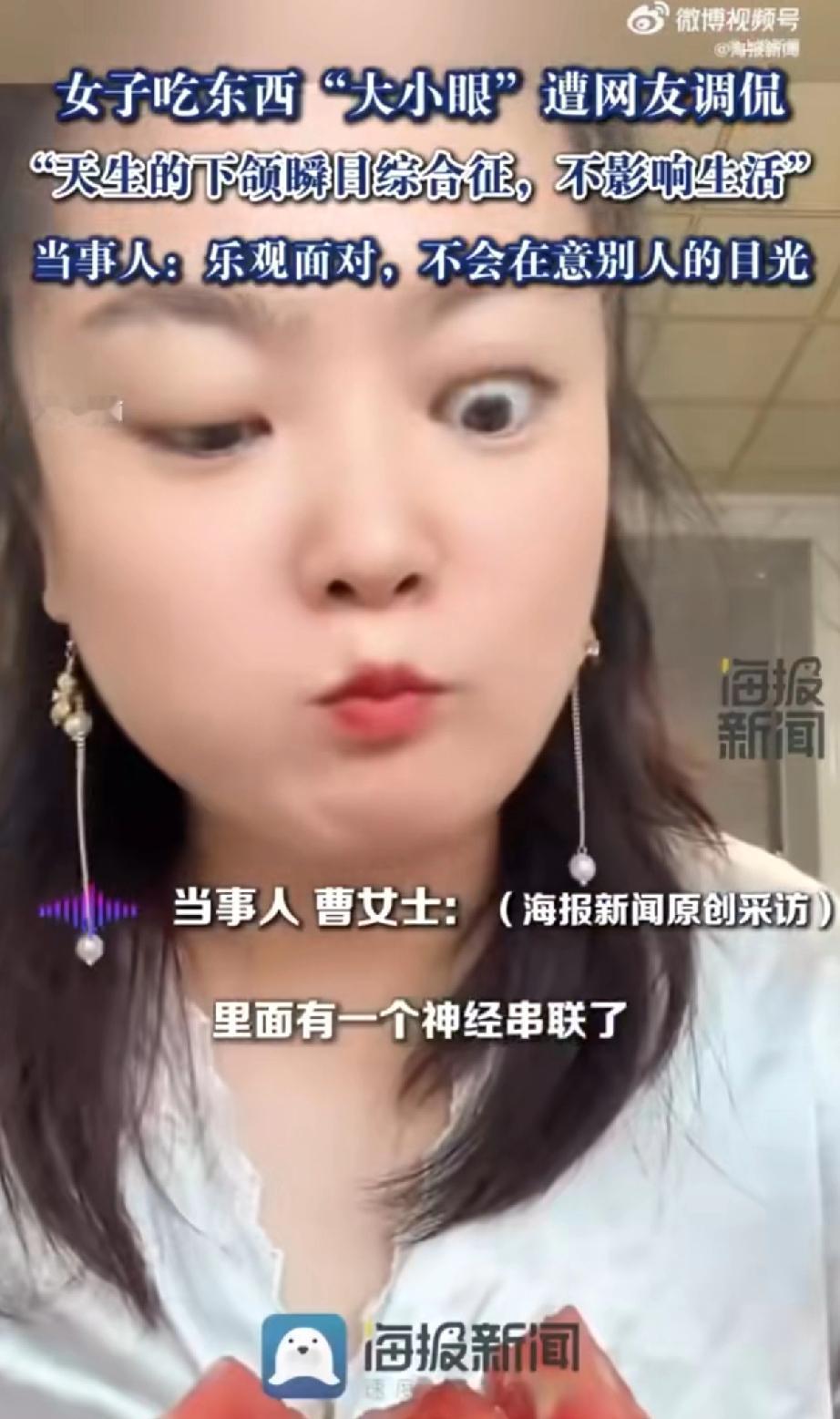 最近，黑龙江鸡西的曹女士火了。原因有点“奇葩”，她一吃东西，眼睛就会变成“大