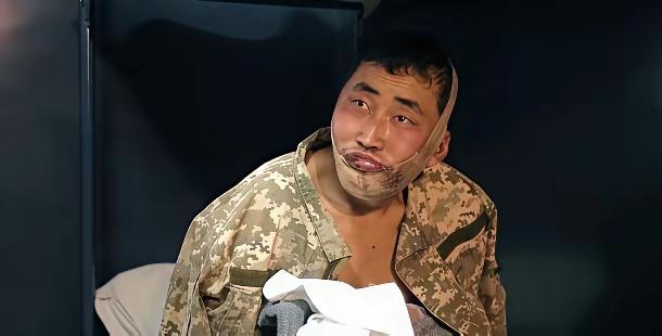 ​两名朝鲜士兵带着绑带去了韩国，对他们来说，这个时候是生死未卜，这些战俘被送往韩