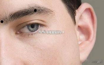 旅行要小心的痣相假如眼眉尾处有痣，外出时要小心，因为这粒痣代表旅行在外易有灾祸，