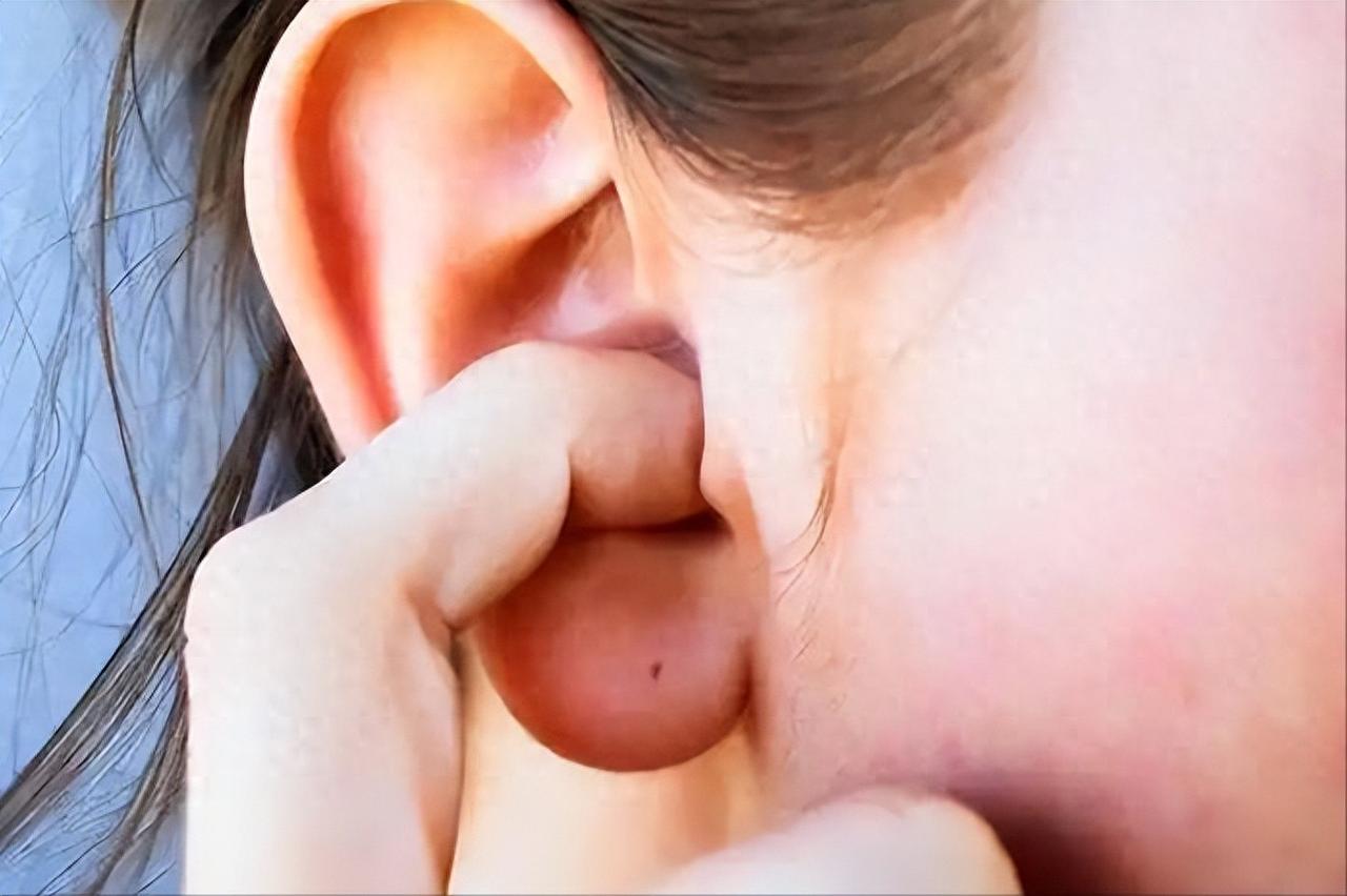 身体出问题，耳朵先知道？耳朵频繁瘙痒，或暗示4种疾病，要警惕耳朵发痒，有时真