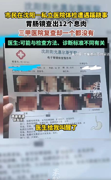 太吓人了！沈阳一名女子陪丈夫参加单位体检，顺手做了胃肠镜。她麻醉还没醒，医生报的