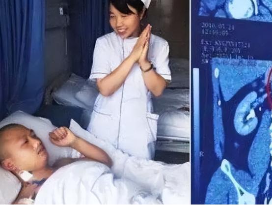 “我的丈夫有4个肾！”2016年，贵州一男子天生神力，可以把白酒当水喝，除此之外