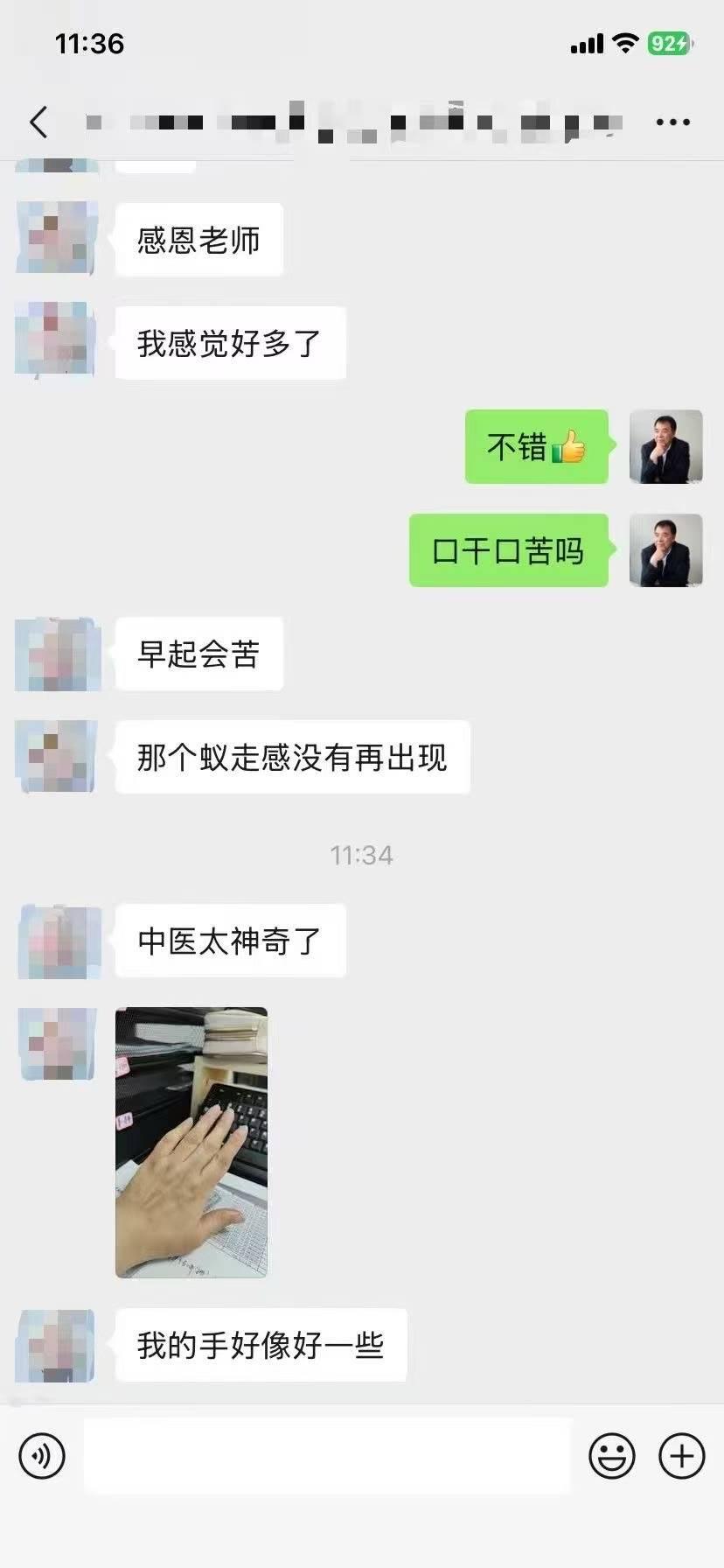 家住陕西的类风湿患者，手指变形，全身反复疼痛，服用中药调理数日，疼痛缓解明显，说