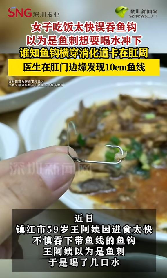 “太震惊了！”6月1日报道，江苏镇江，一女子因吃饭太快，将带线的鱼钩吞了下去，她
