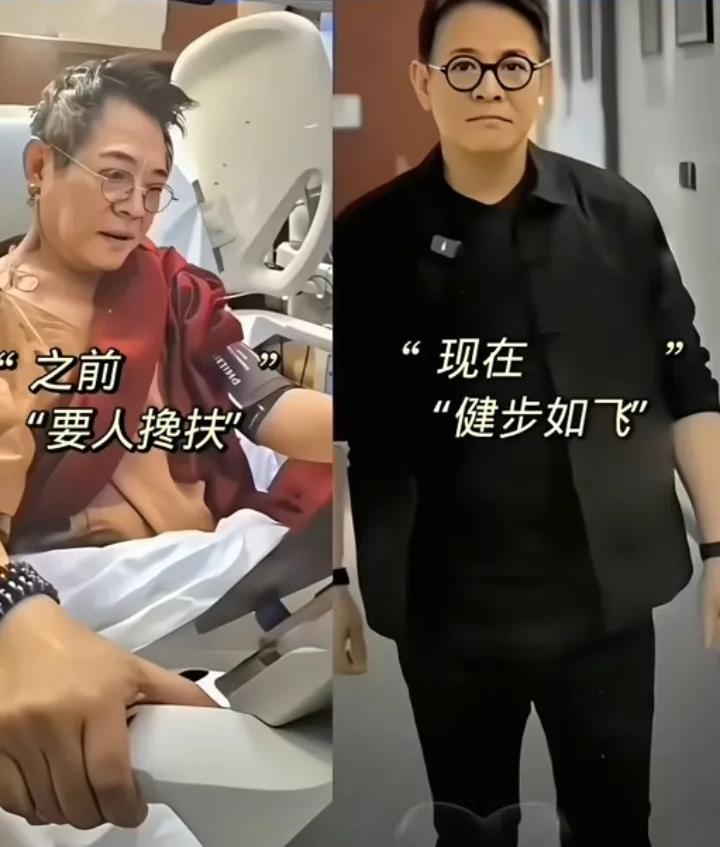 李连杰总算出来回应质疑了他说自己胸膛没有动手术的疤痕很多网友猜测，自己移