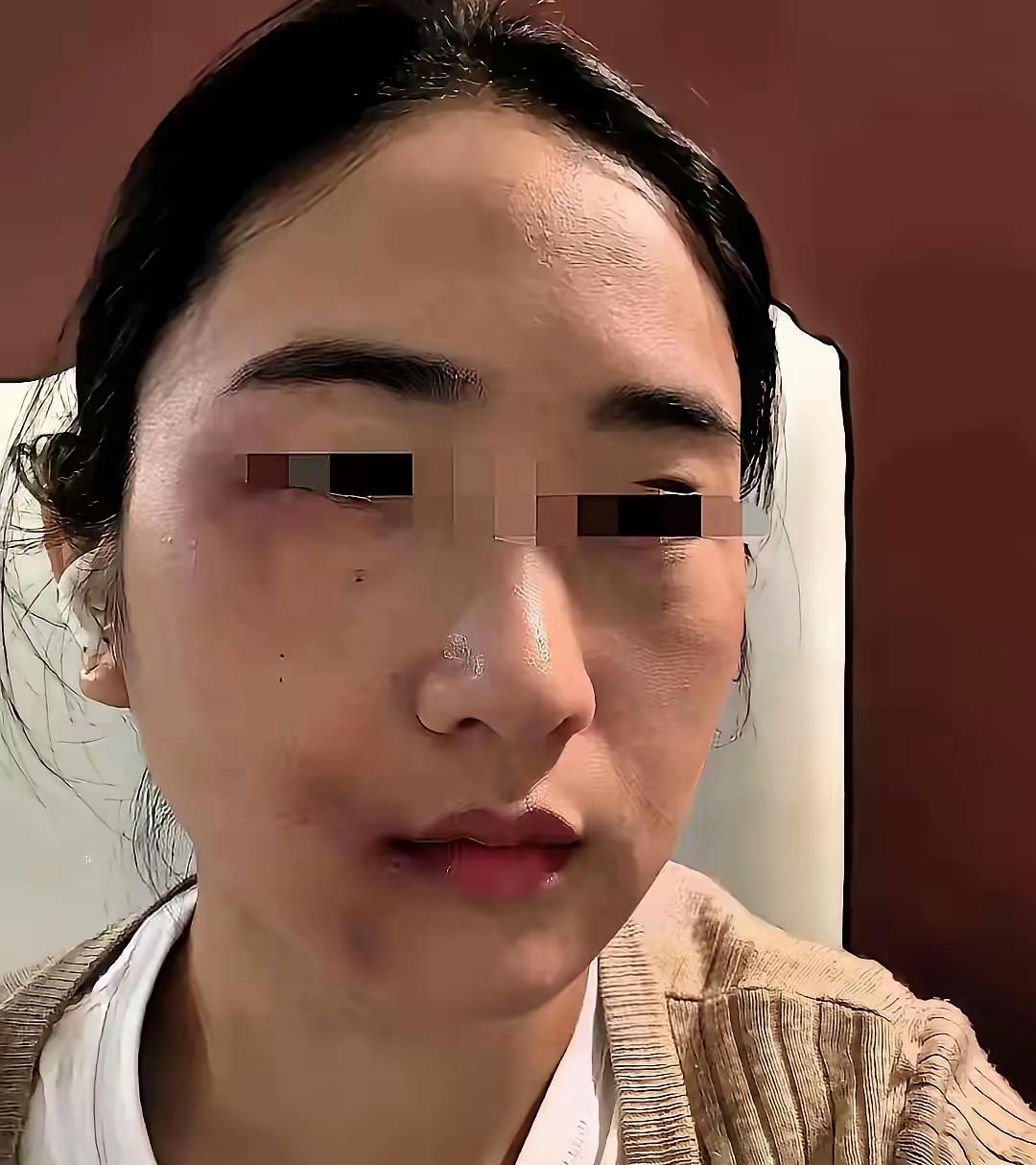 女婿昨天把女儿打了，我气的问啥原因，为什么敢打我的宝贝女儿，女婿说，女儿每天下班
