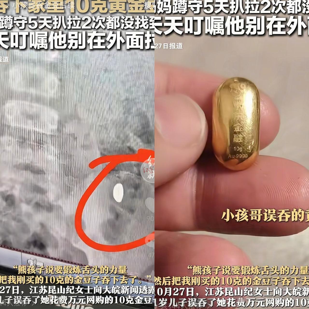 果然金子在哪都会发光!江苏昆山,小孩哥为锻炼舌头,吞下家里10克黄金豆,其妈妈叮