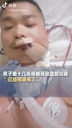 “这下长记性了！”江西宜春，男子嚼槟榔嚼了十几年，每天至少一包，家人苦劝不听，岂