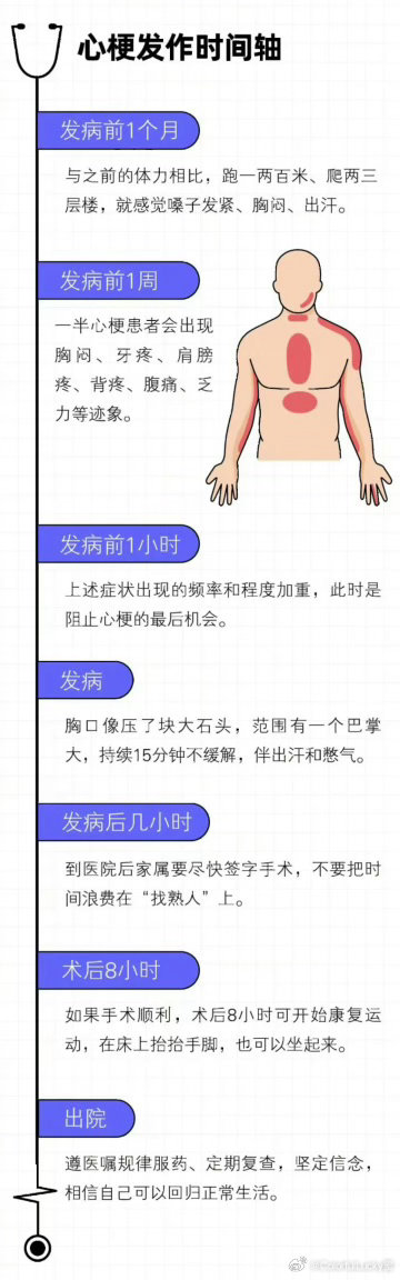 心梗发作前一个月就有征兆1.胸闷、压榨感：胸口发闷、发紧、像压了重物，一阵一