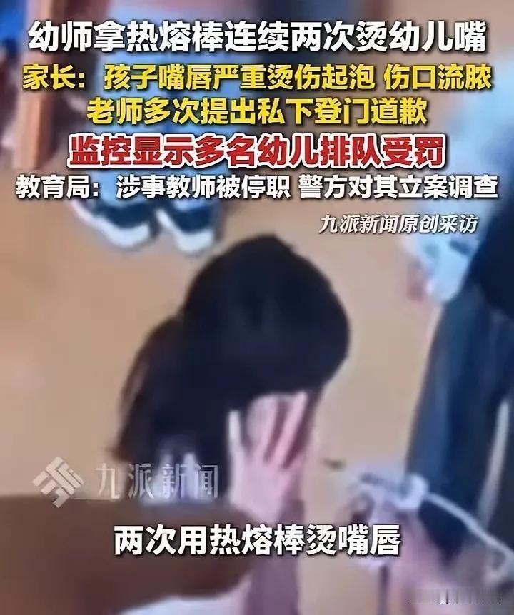 据华商报大风新闻报道，事情发生在江苏徐州丰县机关第二幼儿园实验分园。一位中班女孩