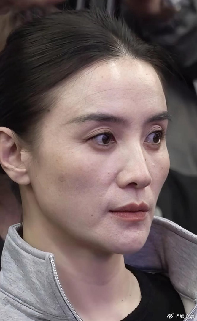 宋佳原生镜头直出，皮肤状态真实又抗打，素颜质感太绝了！