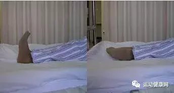 胫骨平台骨折康复方法