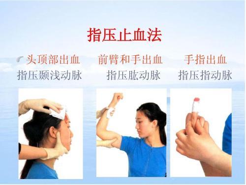 益气止血方止血作用机理分析