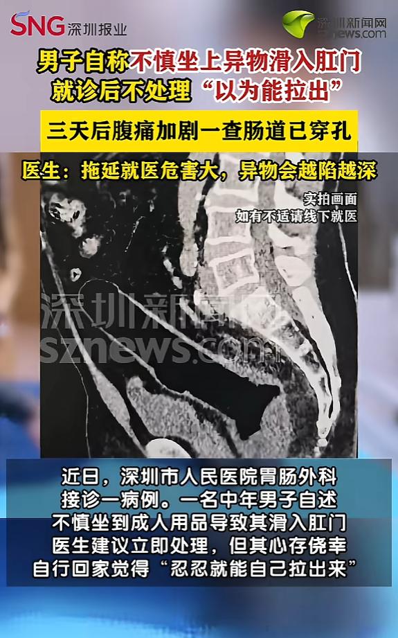 广东深圳，一男子捂着肚子来到医院肛肠科，医生检查时发现肚子里有一个成人用品，男子