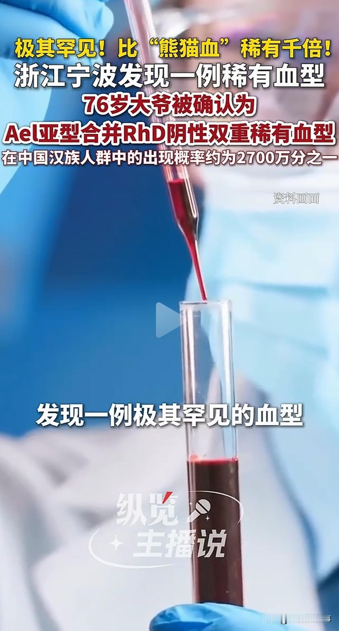 极其罕见！活了76年从没查过血型，宁波大爷骑车摔了一跤，竟查出了全中国都没几