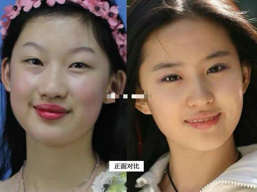 9年前，19岁女孩花百万整成“刘亦菲”，连名字都效仿，如今怎样