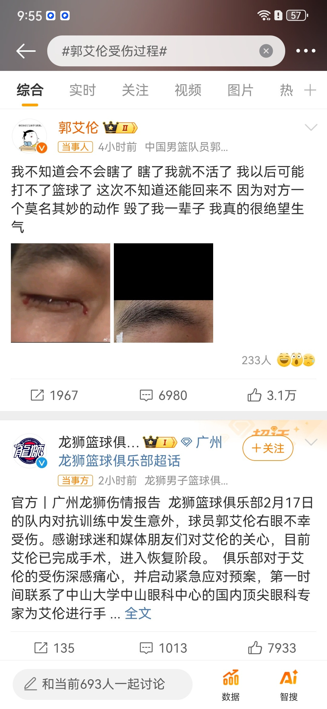 如果是非篮球动作，就应该把肇事者公布出来，不管这个球员是不是故意的，非篮球动作就