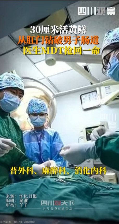 “真是要了命了！”湖南怀化，男子体内钻进了一条30厘米长的大黄鳝，竟然把他的肠子