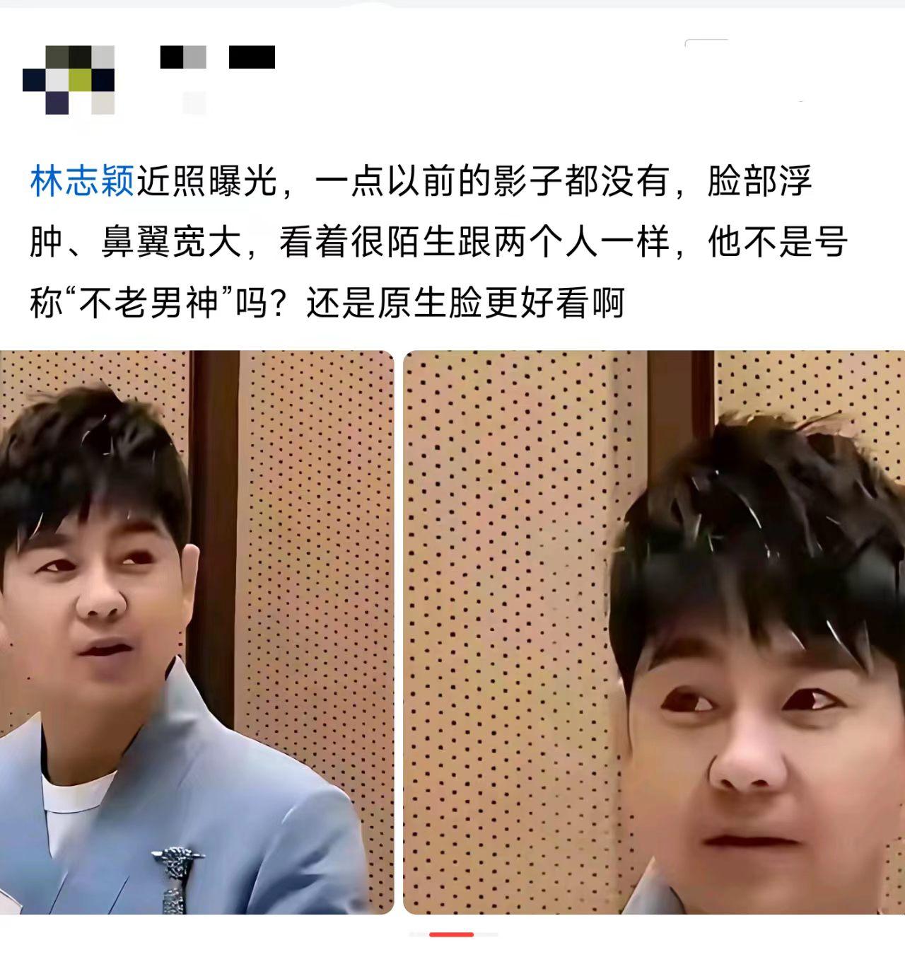这脸还能恢复原样吗？