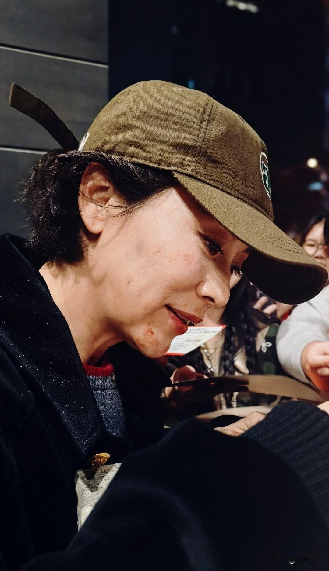 演员海清的脸怎么了，是刚被人“挠”过吗？照片中，她戴着一顶卡其色鸭舌帽，帽檐