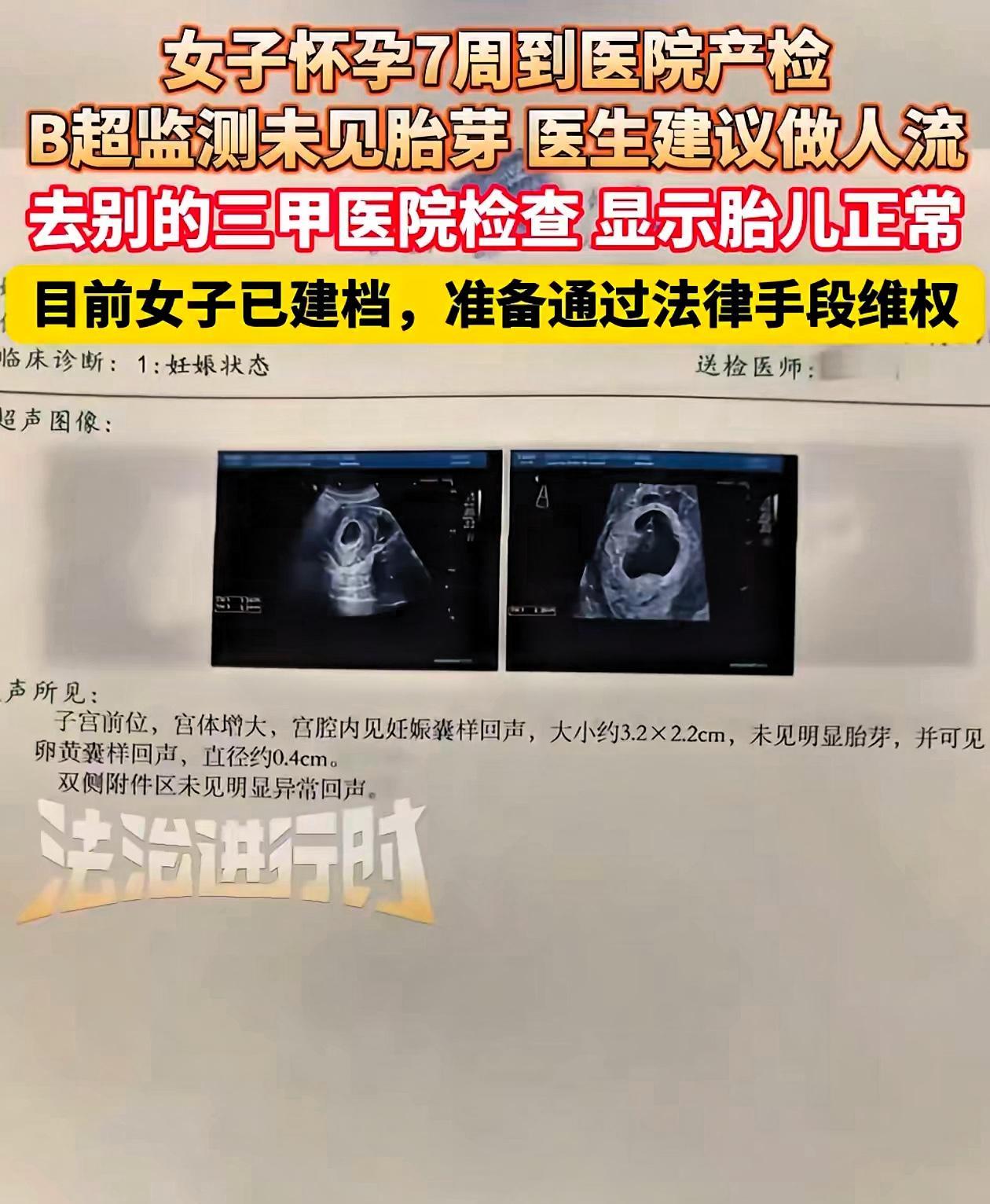 “河北这家医院火了！”有孕妇发视频曝光该医院，说被那里的医生误诊了，差点就听信医