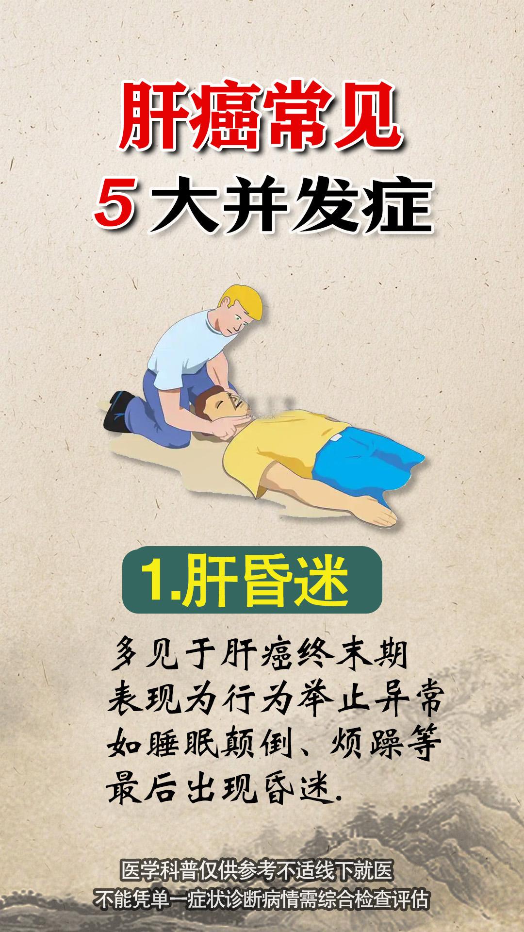 肝癌 肝癌症状 山东肝病医生阚晓 硬核健康科普行动 图文热点来了