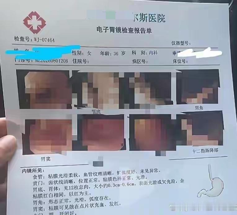 “太坑人”夫妻二人一起去私立医院体检，先是丈夫检出4个胃息肉当场手术切除，后来妻