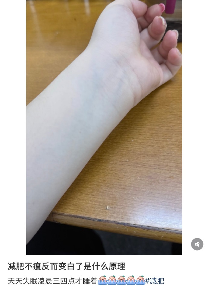 减肥不瘦反而变白了是什么原理