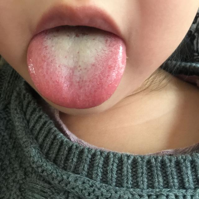 “它”丢锅里一煮! 积食算什么? 吃1次立马消! 4天长高5CM~