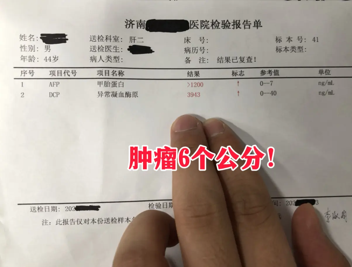 今天门诊收下一位让人惋惜的病人，本身清楚自己携带乙肝，还有肝癌家族史...