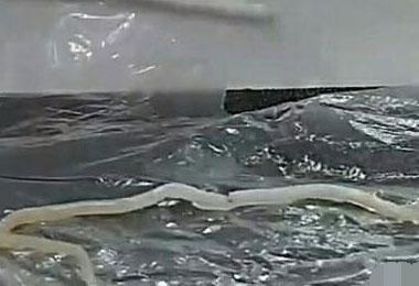 2岁孩子的尿不湿里发现多根白色“皮筋”检查后医生的话吓瘫妈妈