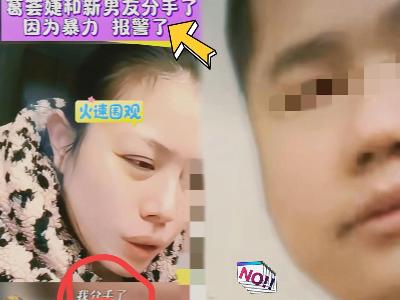 葛荟婕这一巴掌，算是彻底把自己打醒了。花三万块做戒酒手术，出院当天就因为他当