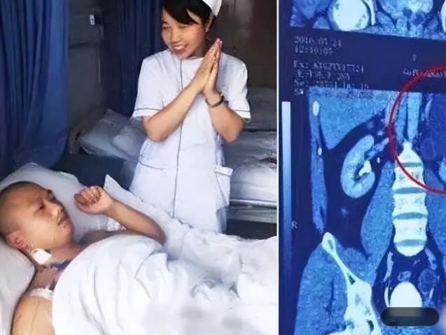 “我的丈夫有4个肾！”2016年贵州，妻子面对镜头羞涩爆料：丈夫王开炼天生异于常