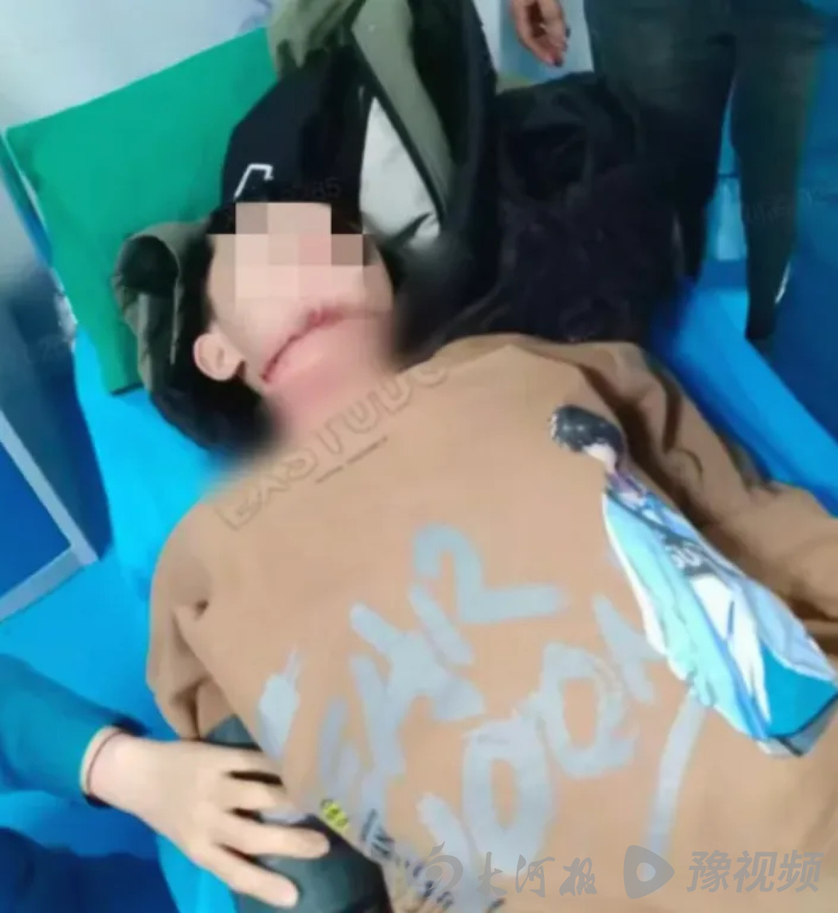 男孩骑车被割喉 涉案者被采取强制措施
