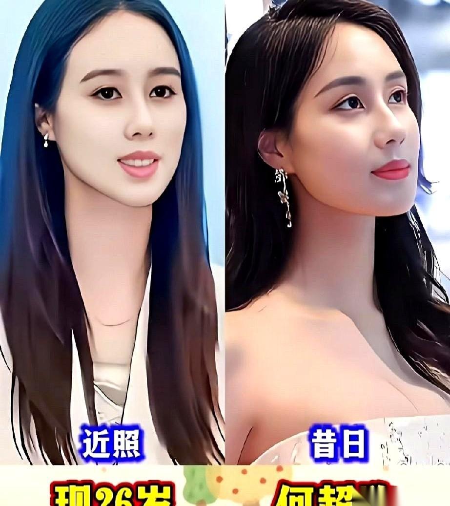 赌王何鸿燊的大女儿何超英，67岁走的，照片上那张脸，却皱得像80岁。她出生就攥