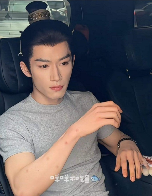 王星越这胳膊上密密麻麻的圆点是啥？蚊子咬的嘛？？？？​​​