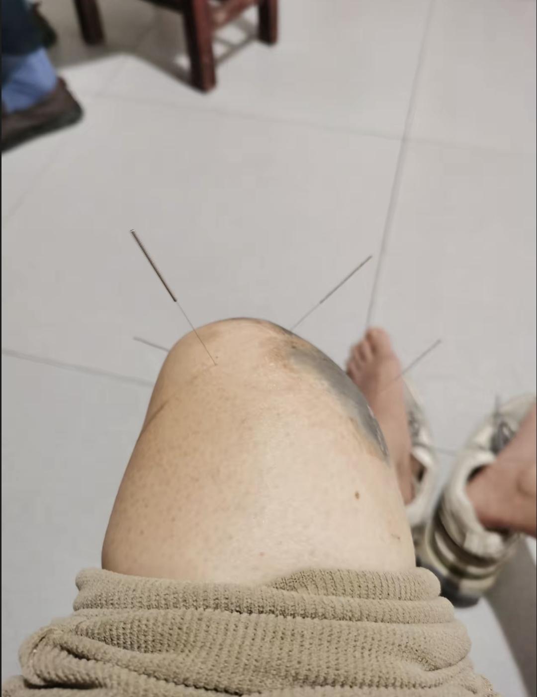 我年轻那会儿不爱惜身体，走路跑跳累得要命。现在五十多岁膝盖就出毛病了，走路都疼。