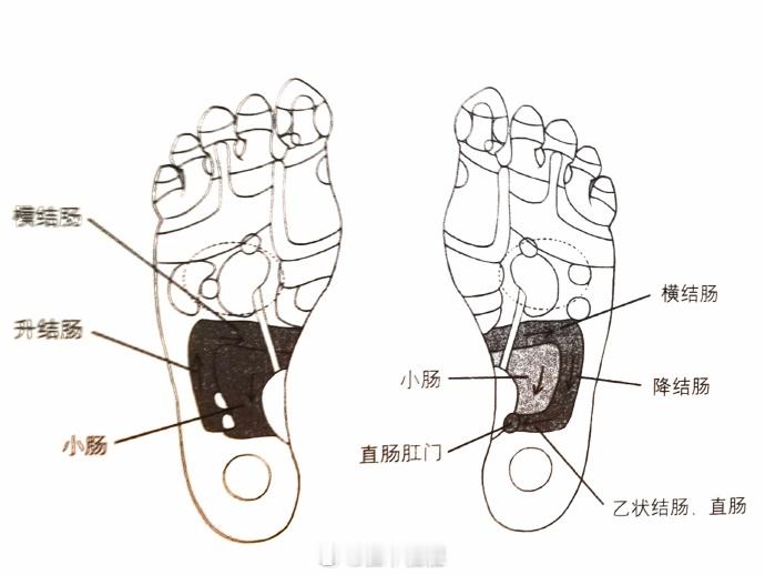 便秘就推推肠道反射区便秘困难，几天不排便，可以推推足底的肠道反射区。足底肠道反射