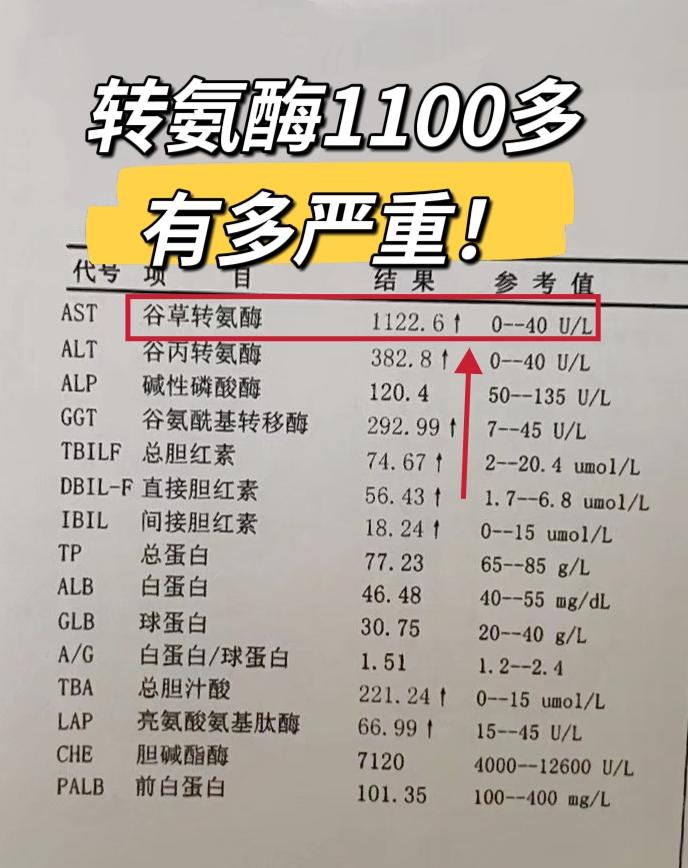 转氨酶1100多有多严重！多高算高。转氨酶正常情况下是0~40之间 ...