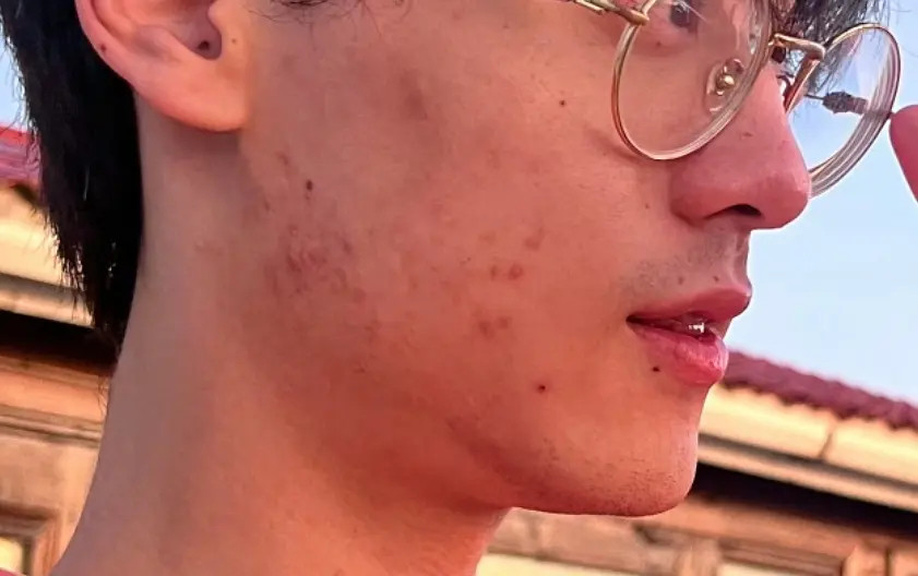 为何赚了这么多钱也不做皮肤管理医美？