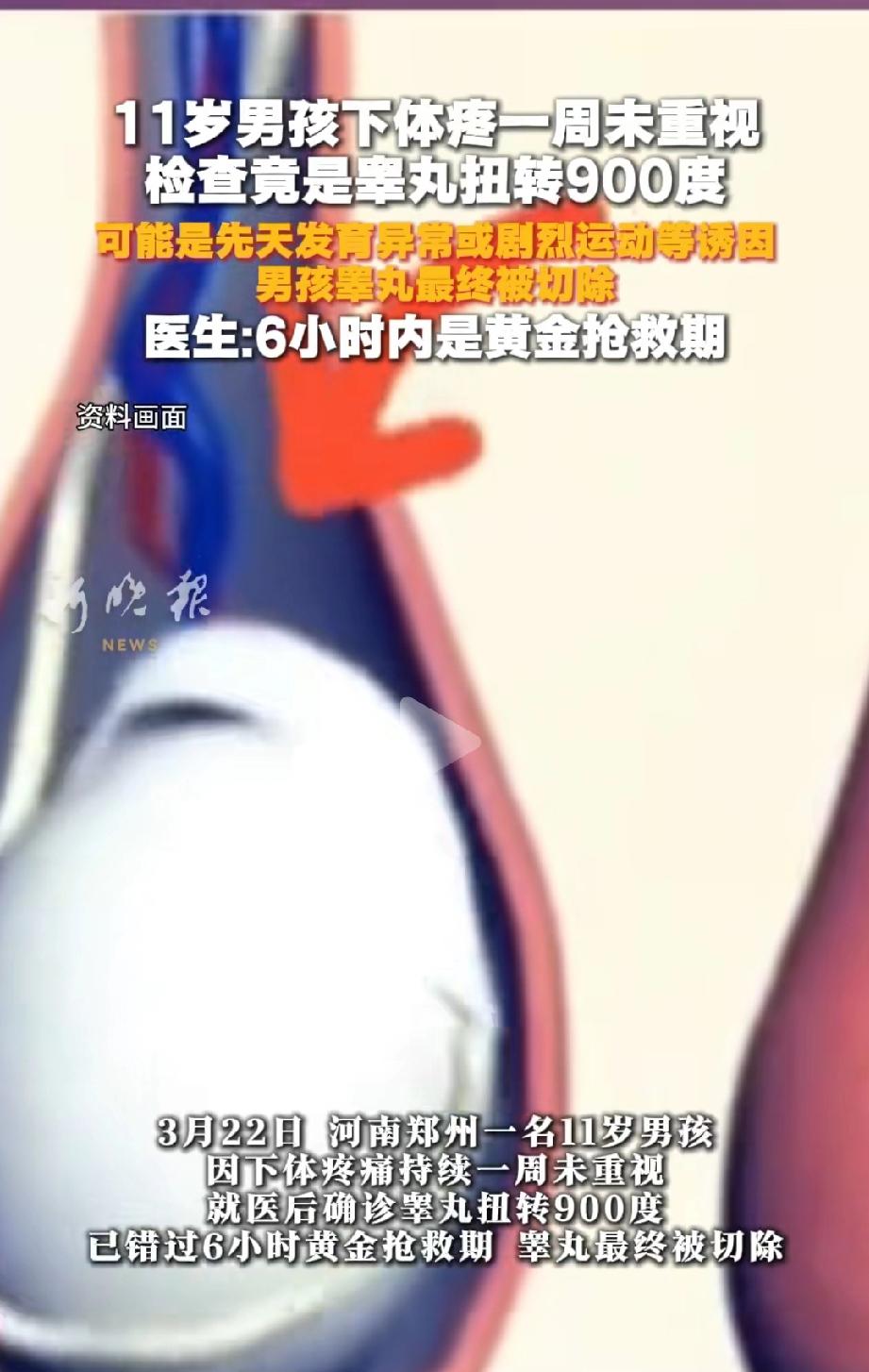 听的都疼！河南郑州，一名11岁男孩下体疼了整整一个星期，愣是没敢跟大人说。等家长